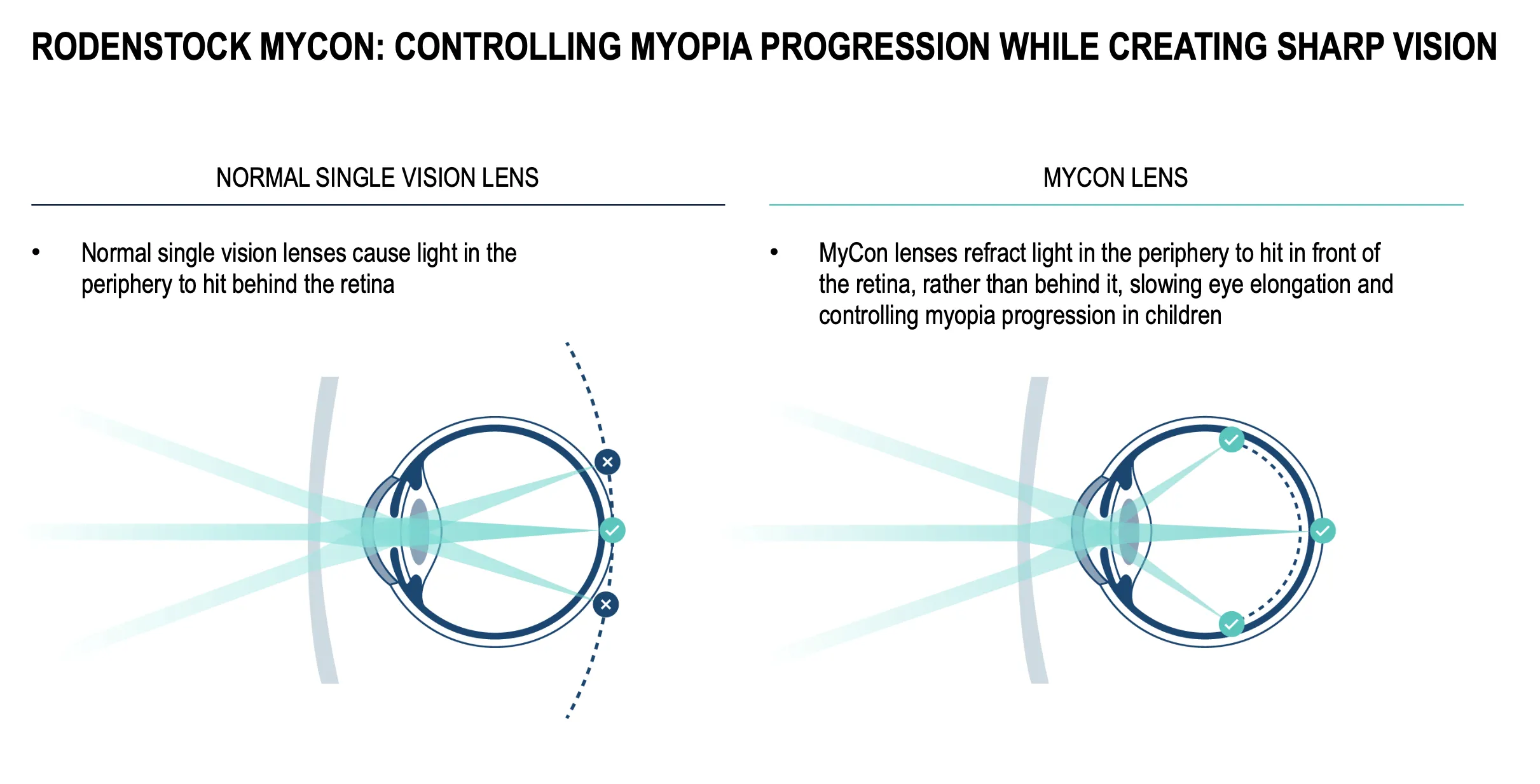 Princip okuliarových šošoviek MyCon